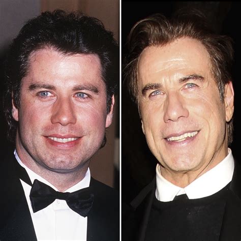 john travolta face lift|Decoding John Travolta’s Plastic Surgery Transformation Rumors